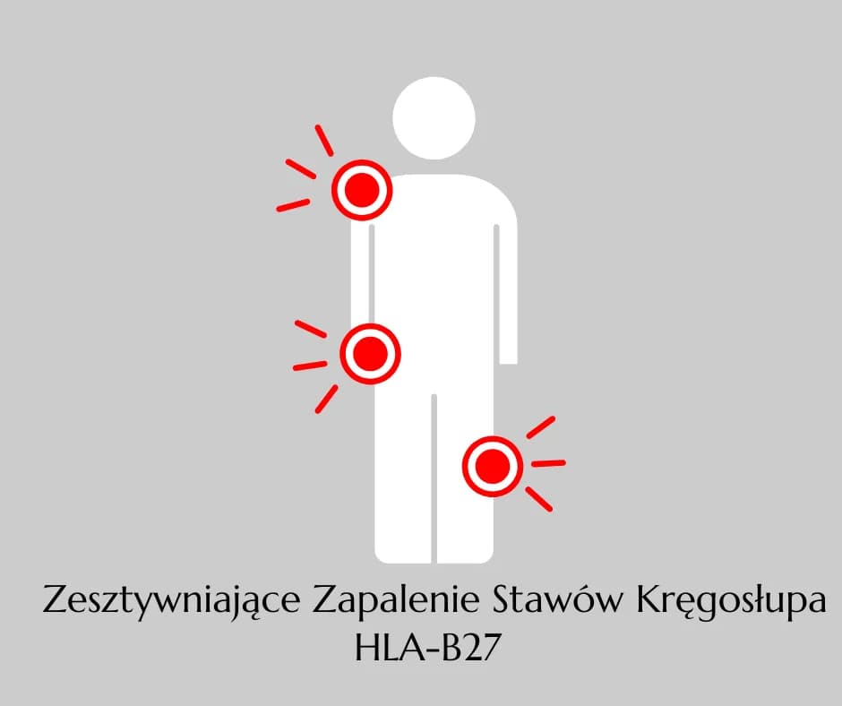 HLA-B27: Co to za badanie i kiedy jest zalecane? Wyjaśniamy HLA-B27: Co to za badanie i kiedy jest zalecane? Wyjaśniamy