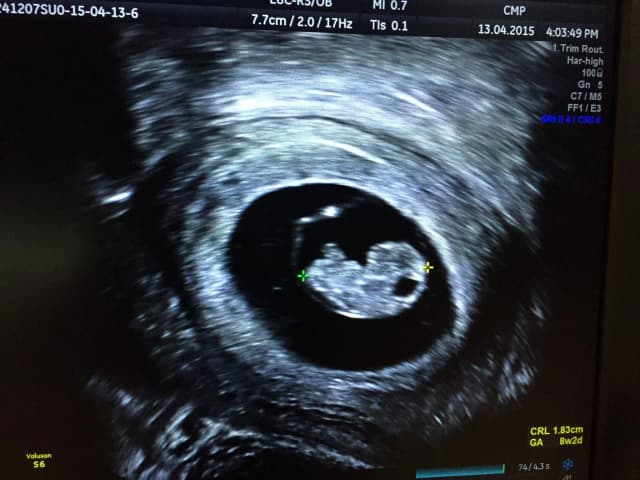 Po jakim czasie widać ciążę? Pierwsze oznaki i metody wykrywania Po jakim czasie widać ciążę? Pierwsze oznaki i metody wykrywania