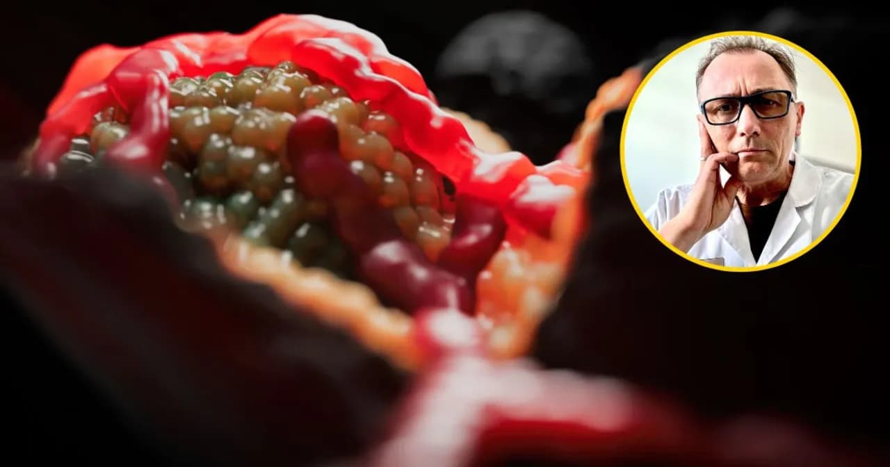 Gruczolak trzustki: objawy, które powinny Cię zaniepokoić Gruczolak trzustki: objawy, które powinny Cię zaniepokoić