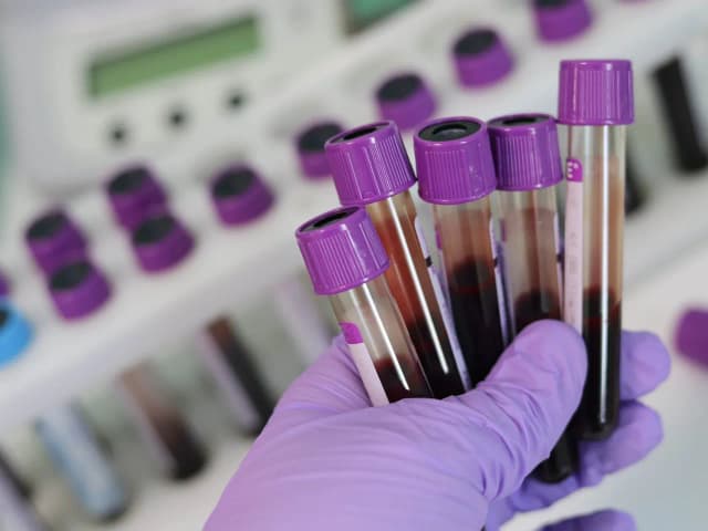 Skierowanie na badania krwi - jak długo ważne? Sprawdź fakty Skierowanie na badania krwi - jak długo ważne? Sprawdź fakty