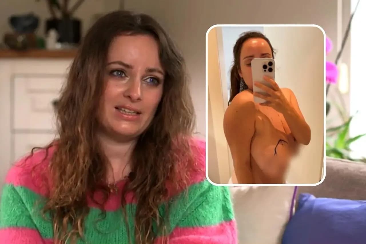 Operacja zmniejszenia biustu NFZ - gdzie i jak ją zrobić bezpłatnie? Operacja zmniejszenia biustu NFZ - gdzie i jak ją zrobić bezpłatnie?