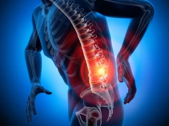 Leki na złamanie patologiczne kręgosłupa: skuteczne metody leczenia Leki na złamanie patologiczne kręgosłupa: skuteczne metody leczenia