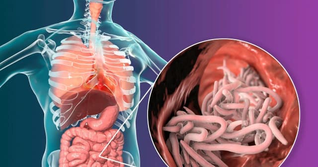 Skuteczne leki na glistę ludzką: dawkowanie i działanie Skuteczne leki na glistę ludzką: dawkowanie i działanie