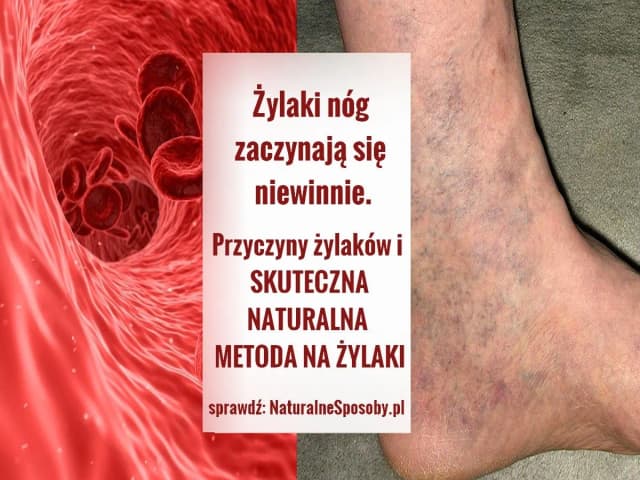 Skuteczne sposoby na ból nóg w ciąży - ulga dla przyszłych mam Skuteczne sposoby na ból nóg w ciąży - ulga dla przyszłych mam