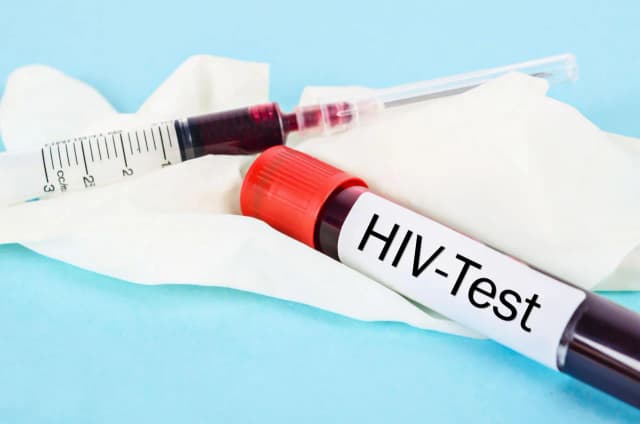 Badania na HIV: Jak wyglądają i czego się spodziewać? Kompletny opis Badania na HIV: Jak wyglądają i czego się spodziewać? Kompletny opis